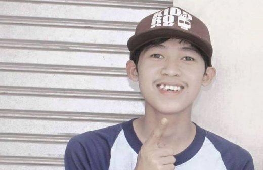 Dikerjai dengan telur busuk saat ultah, pemuda 16 tahun harus cangkok mata Rp 50 juta