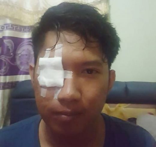 Naik motor sambil ngerokok, mata pengendara lain kelilipan bara apinya