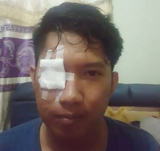 Naik motor sambil ngerokok, mata pengendara lain kelilipan bara apinya