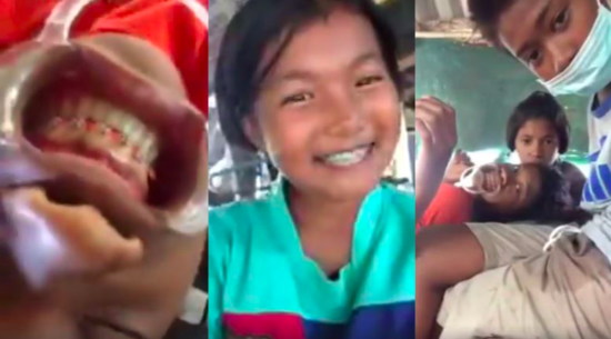 WATCH: Video anak sekolah jadi dokter gigi KW, tangani dua pasien pasang behel