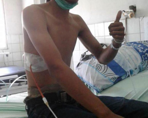 Gara-gara rokok paru-paru suami kempes dan harus dibor, curhat istri di Facebook viral