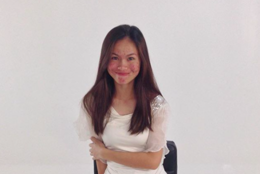 Banyak jerawat di wajahnya, remaja 18 tahun di Malaysia tetap PD meski sering dicela