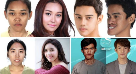 Pemerintah Thailand sarankan pasien oplas ganti kartu identitas dengan foto terbaru