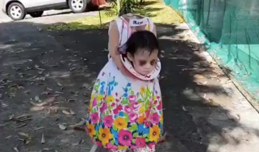 Anak berkostum kepala buntung untuk Halloween, ngeri tapi gemes